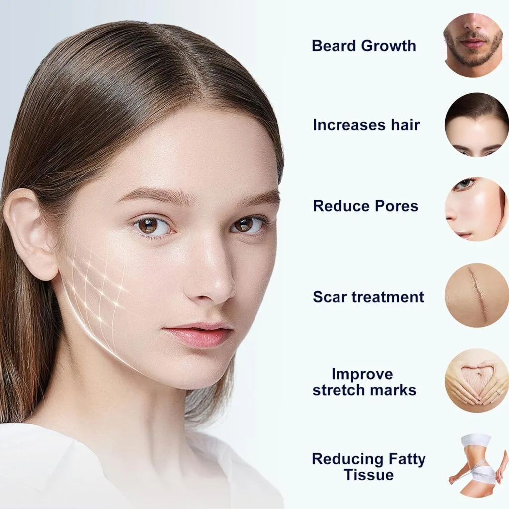 Une femme avec des rides numériques sur la joue ; le texte latéral énumère les avantages du Tampon Stempel Microneedling Réglable 0-3mm (140 aiguilles en titane) : croissance de la barbe, plus de cheveux, pores minimisés, soin des cicatrices et des vergetures, réduction de la graisse, ainsi que des images d'outils.